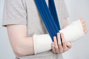 Broken Bones and Rehab: A Family Guide for Summer Recovery
