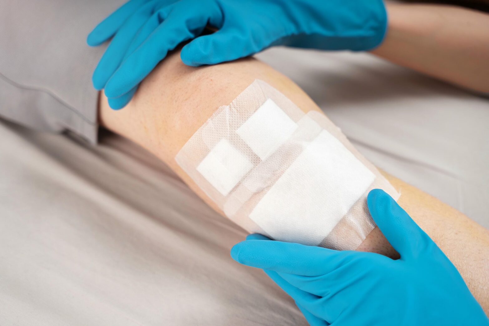 Wound Care After Surgery in July: How Skilled Nursing Helps Prevent Setbacks