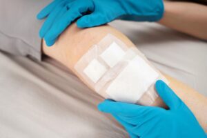 Wound Care After Surgery in July: How Skilled Nursing Helps Prevent Setbacks